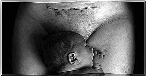 Cesarean section is not the "easy way"